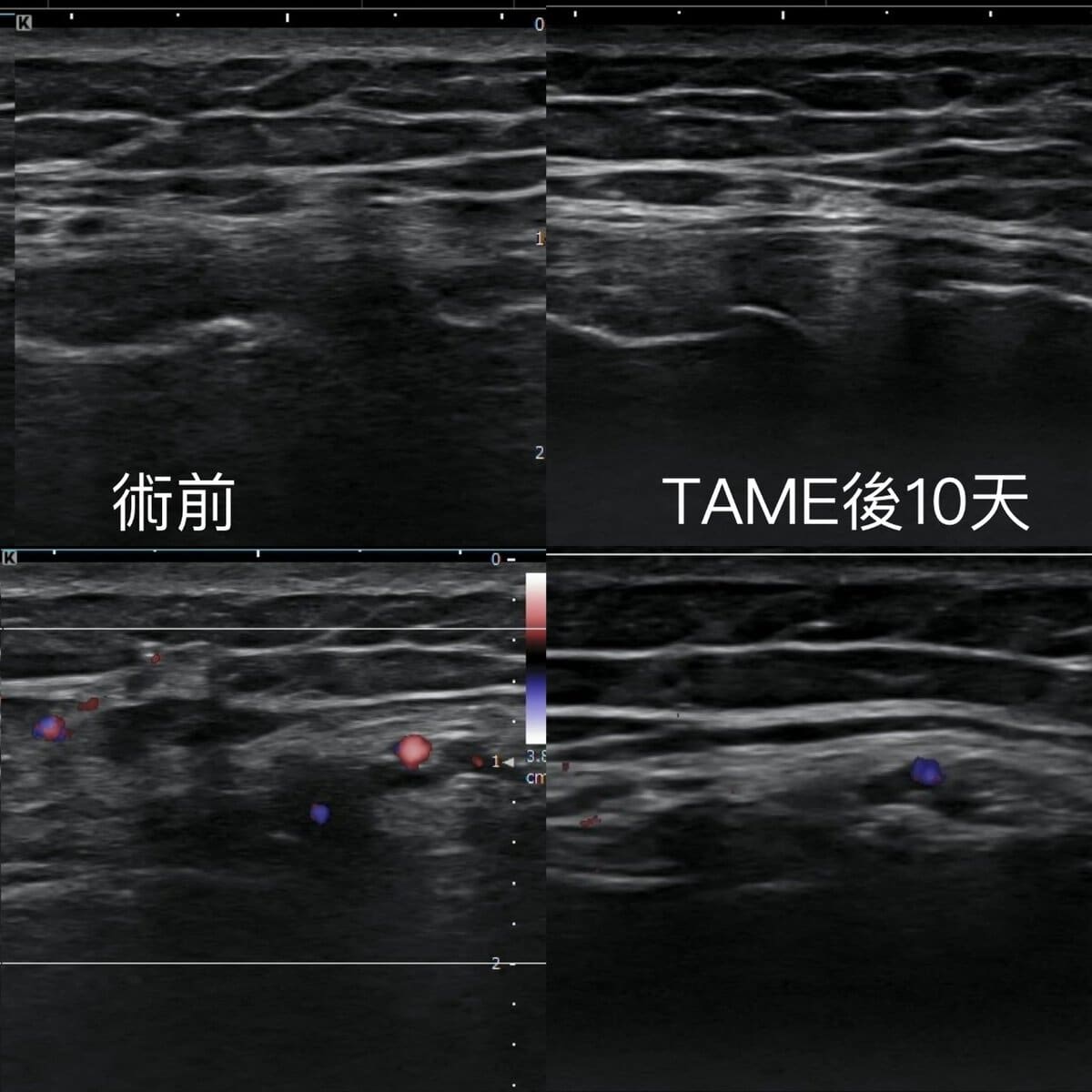 20250725-muq0a