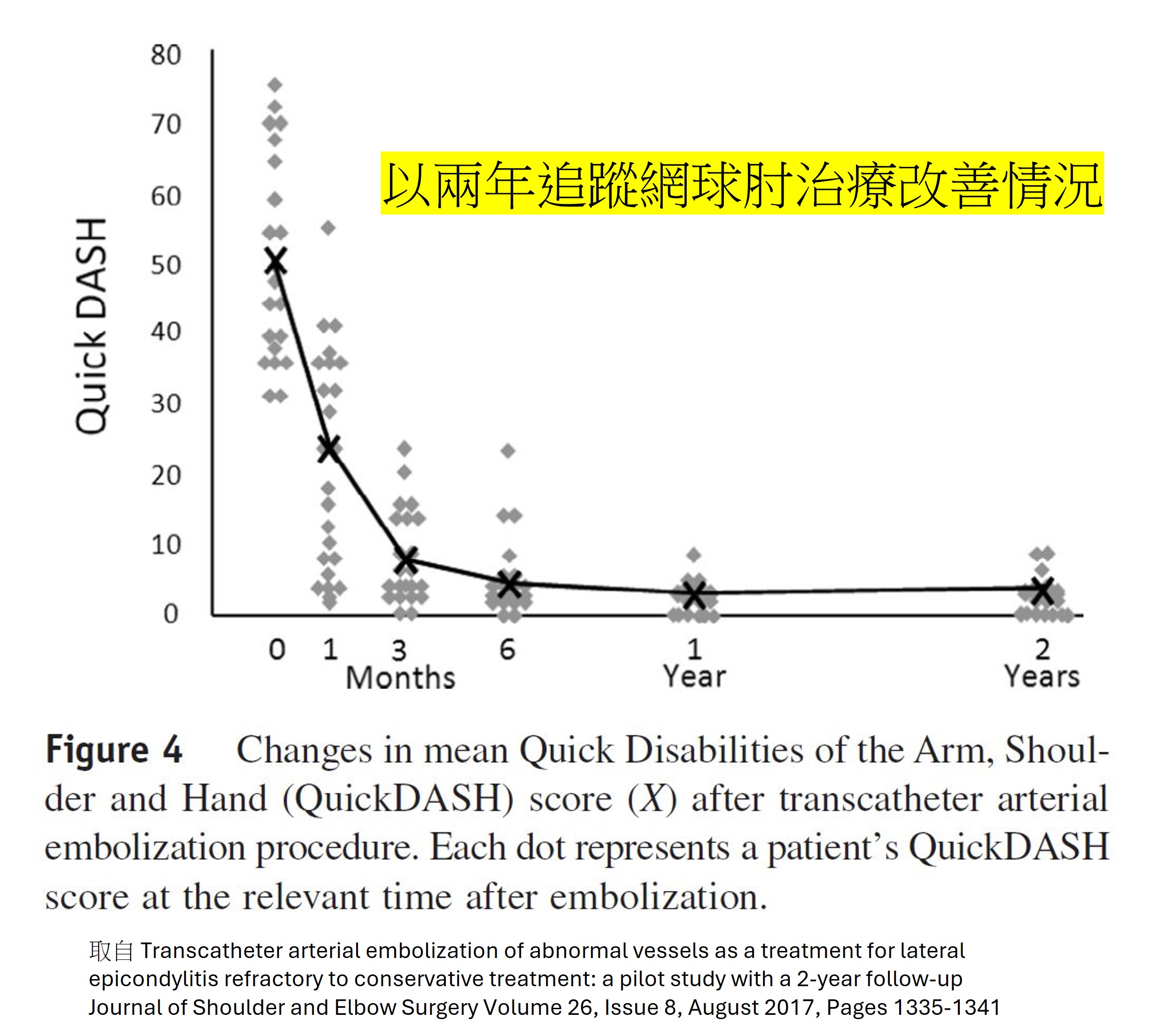 微細動脈栓塞 (TAME) 是什麼? 從血管來控制疼痛? 微細動脈栓塞的原理、作法、效果與風險 - 第5張圖