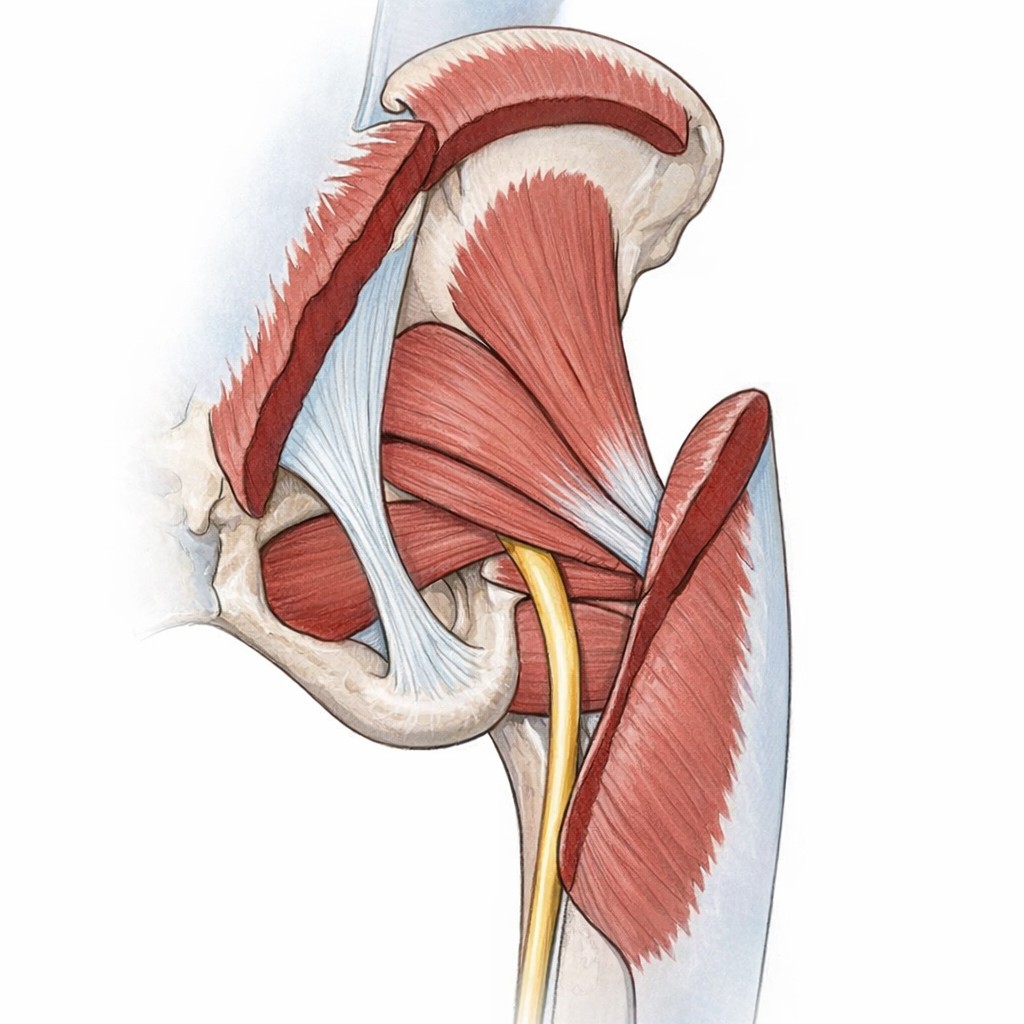 一坐下屁股就痛怎麼辦？超音波解析「坐骨結節痛」是腿後肌腱炎，還是深臀神經夾擠