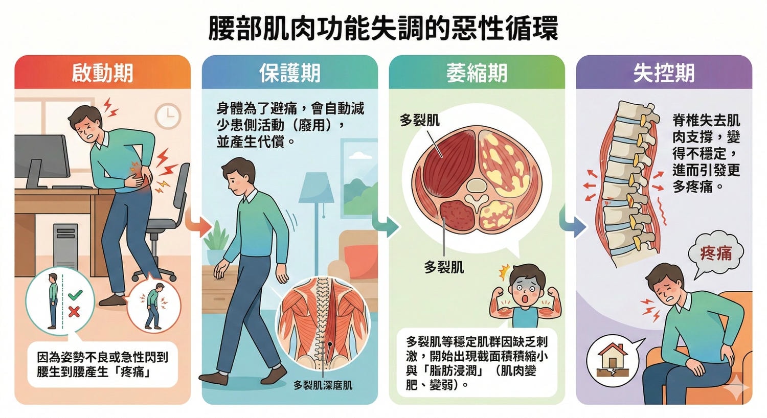 下背痛只是腰閃到? 醫師帶你看懂豎脊肌萎縮與神經痛的關係：脂肪浸潤、萎縮與腳麻的真相