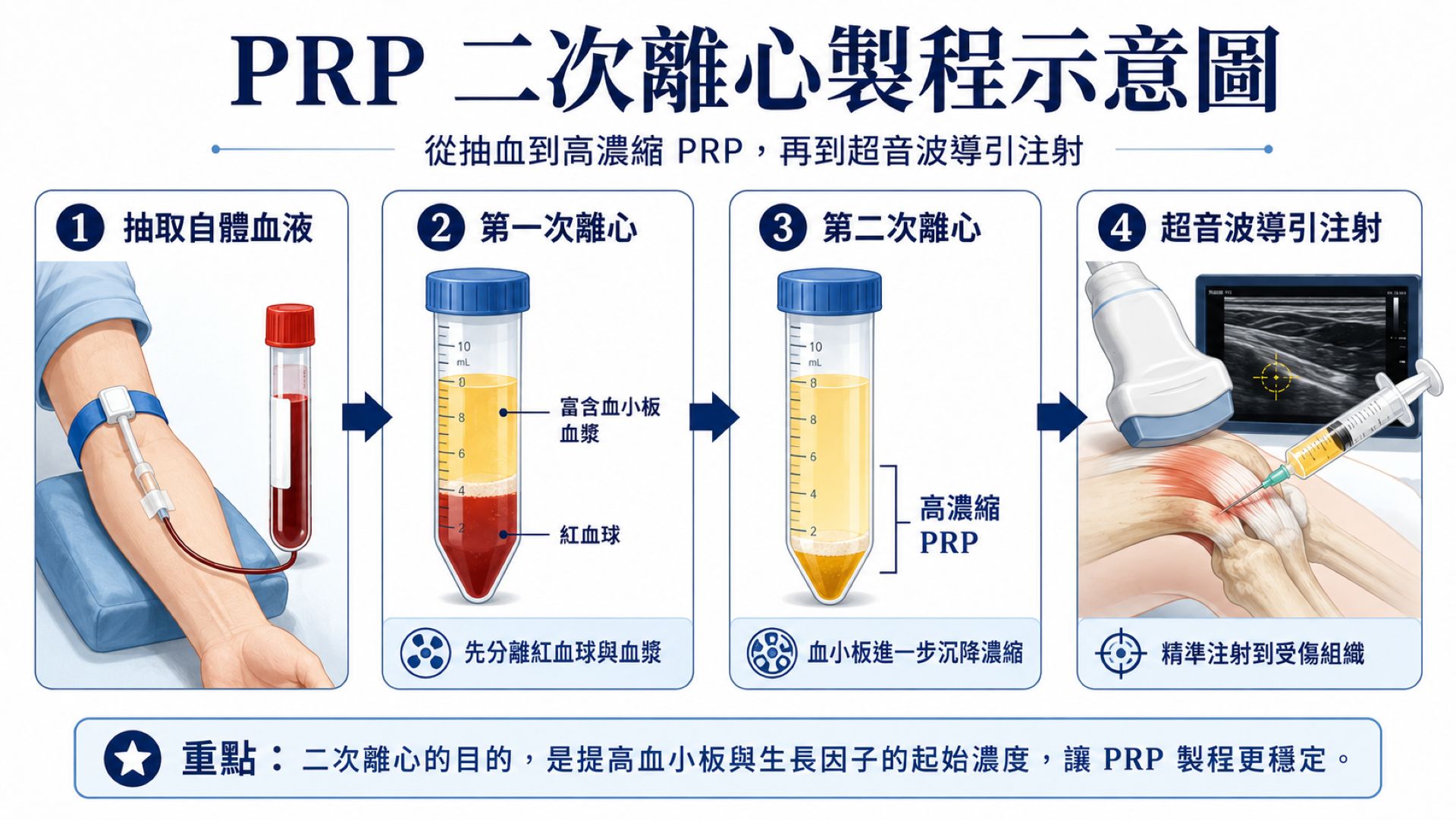 PRP二次離心