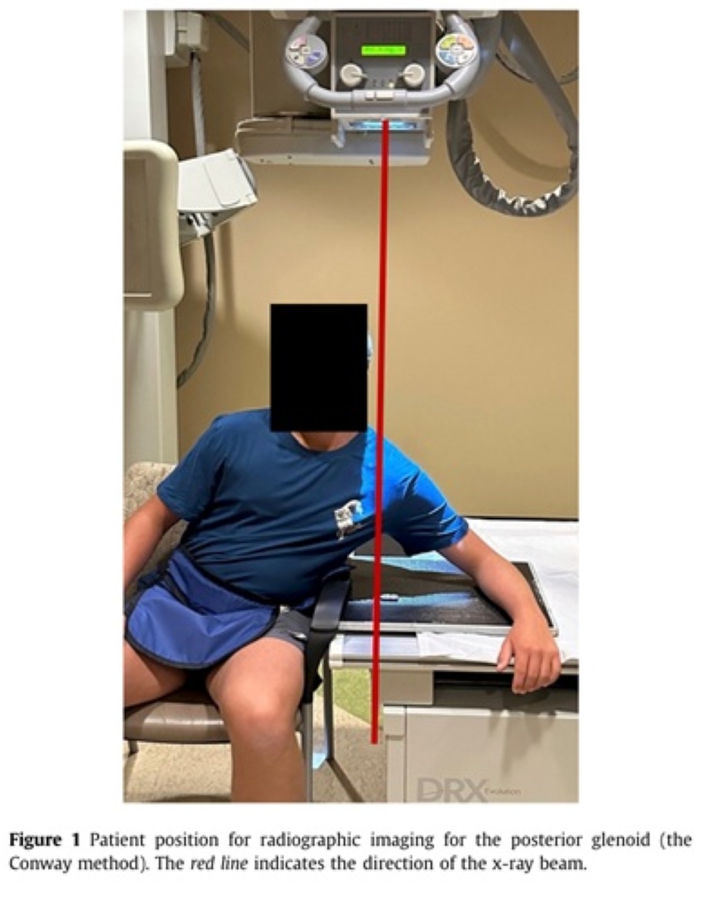 改良式腋下角度（Conway 法）拍攝姿勢示範：患者坐姿前傾趴在檢查台上，X 光球管由上往下投照，紅線標示 X 光束方向，用來呈現肩盂後緣